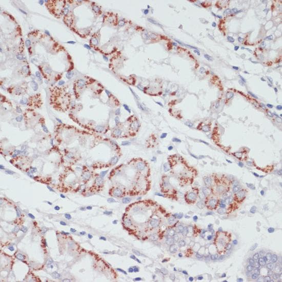 Polyclonal Rabbit anti-Human ACSL3 Antibody (IHC)