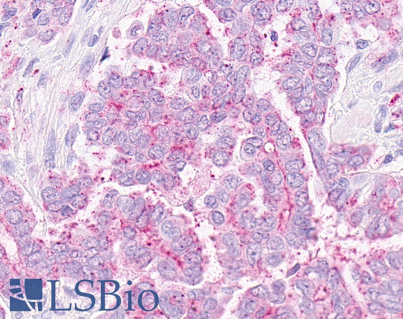 PathPlus™ OXER1 Antibody (C-Terminus)