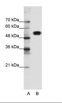 CLCNKB Antibody (N-Terminus)