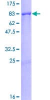 Human MCCC2 / MCCB Protein (Recombinant GST)