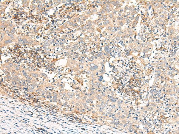 GBP4 / Mpa2 Antibody