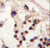 TESK2 Antibody (aa210-240)