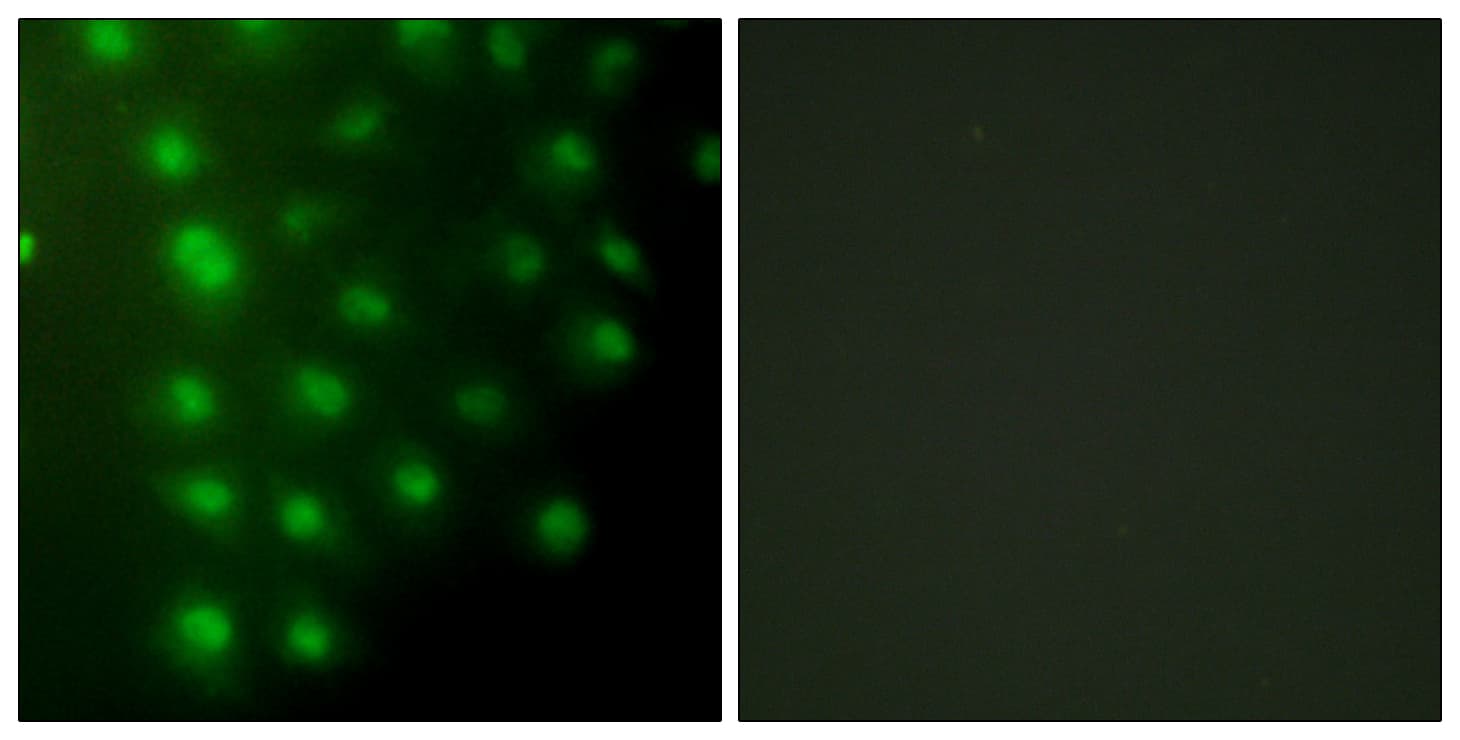 IHC-plus™ AKAP8 / AKAP95 Antibody (aa331-380)