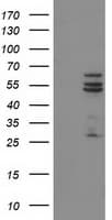 Monoclonal Mouse anti-Human CYP2C9 / Cytochrome P450 2C9 Antibody (clone OTI1D7, IHC, IF, WB)