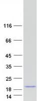 Human VAMP5 / VAMP-5 Protein (Recombinant Myc-DDK (Flag))