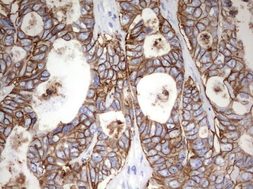 EPCAM Antibody (clone UMAB132, Carrier-free)