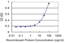 UPB1 Antibody (clone 3F12)