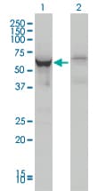 Monoclonal Mouse anti-Human DDX56 Antibody (clone 4C5, IHC, IF, WB)