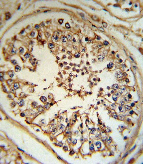 Polyclonal Rabbit anti-Human INHA / Inhibin Alpha Antibody (aa79-108, IHC, IF, WB)