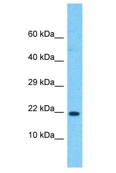 RPL24 / Ribosomal Protein L24 Antibody (aa31-80)