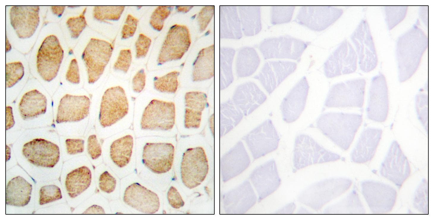 Actinin-Alpha 2+3 Antibody