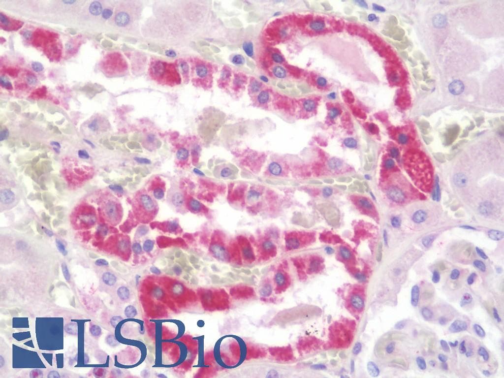 IHC-plus™ CCL2 / MCP1 Antibody (aa62-89)