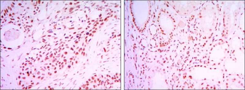 SIRT1 / Sirtuin 1 Antibody (clone 1F3)
