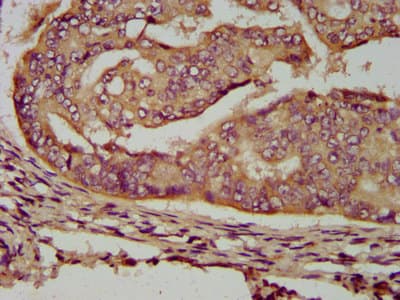 ENOSF1 Antibody