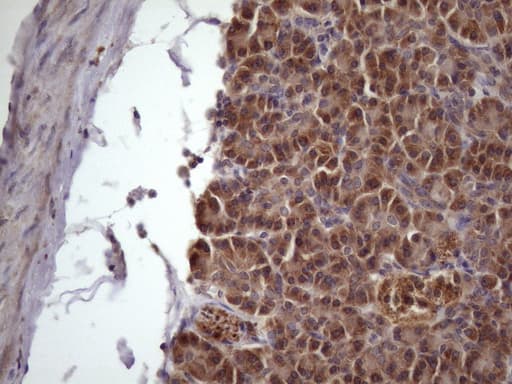NDUFB11 Antibody (aa30-163, clone OTI9C5)