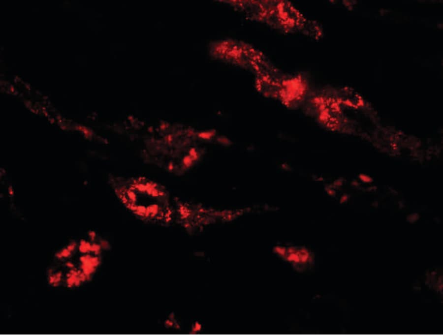 Polyclonal Rabbit anti-Human PEAR1 Antibody (IHC, IF, WB)