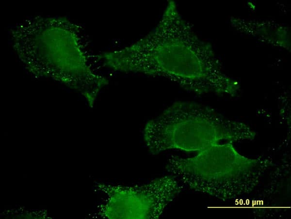 ALDH9A1 Antibody (clone 3C6)