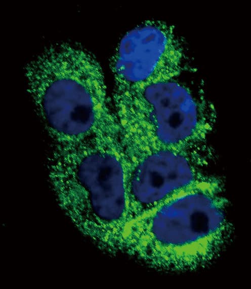 Polyclonal Rabbit anti-Human COL6A1 / Collagen VI Alpha 1 Antibody (aa831-858, IHC, IF, WB)