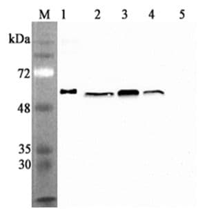 CALR / Calreticulin Antibody (clone CR213-2AG)