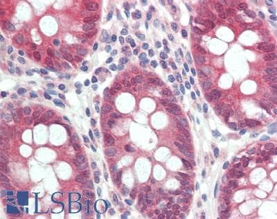 IHC-plus™ Polyclonal Rabbit anti-Human GIPC2 Antibody (aa252-279, IHC, WB)
