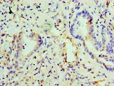 EGLN2 / PHD1 Antibody