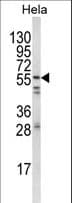 Polyclonal Rabbit anti-Human SYN / FYN Antibody (aa1-30, IHC, WB)
