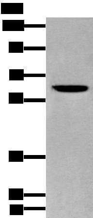 ZKSCAN1 / ZNF36 Antibody