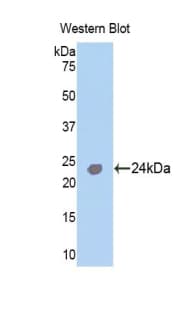 TNNI1 Antibody (aa1-187)