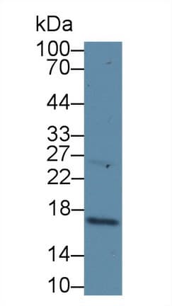 p16INK4a / CDKN2A Antibody (aa8-156)