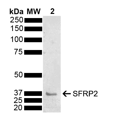 SFRP2 Antibody (RPE)