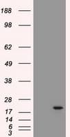 Monoclonal Mouse anti-Human AK1 / Adenylate Kinase 1 Antibody (clone OTI4A1, IF, WB)