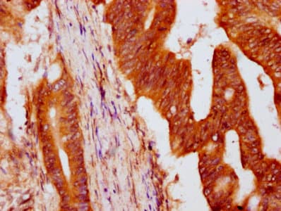 HIST1H4I Antibody