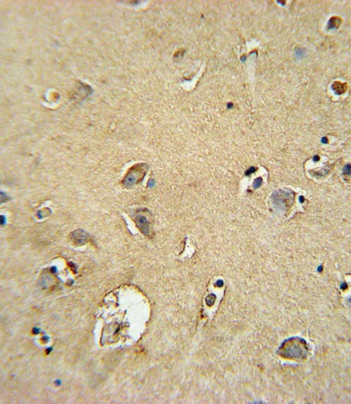 Polyclonal Rabbit anti-Human SMS / Spermine Synthase Antibody (IHC, WB)