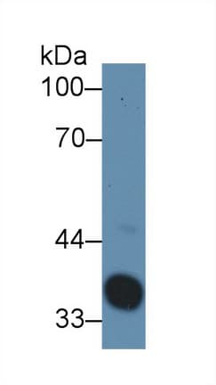 HP / Haptoglobin Antibody (aa104-346, Biotin)