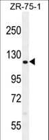 CCDC33 Antibody (aa873-901)