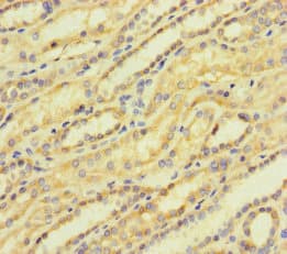 Polyclonal Rabbit anti-Human ACTR5 / ARP5 Antibody (IHC, IF)