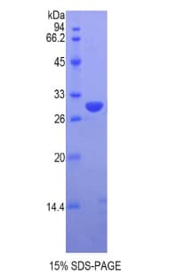 Human VRK1 Protein (Recombinant His)