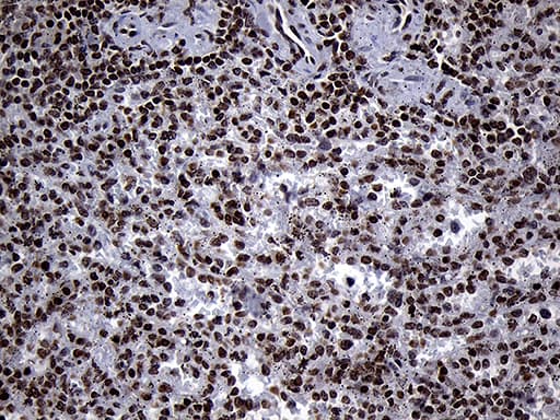 Monoclonal Mouse anti-Human SPANXB1 Antibody (clone OTI6G2, IHC, WB)