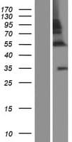 ZNF783 Protein (Over-Expression Lysate Myc-DDK (Flag))