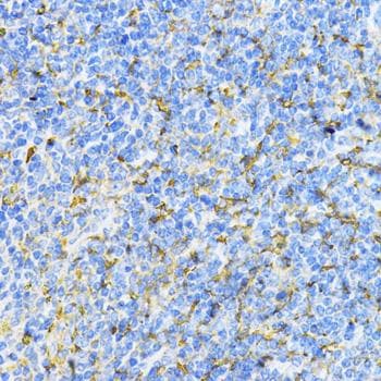 CD274 / B7-H1 / PD-L1 Antibody