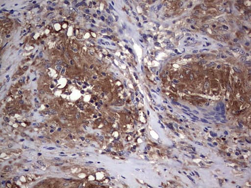 Monoclonal Mouse anti-Human CSNK1E / CK1 Epsilon Antibody (clone OTI5H10, aa153-416, IHC, WB)