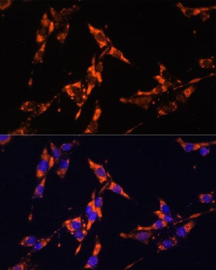 IL18 Antibody