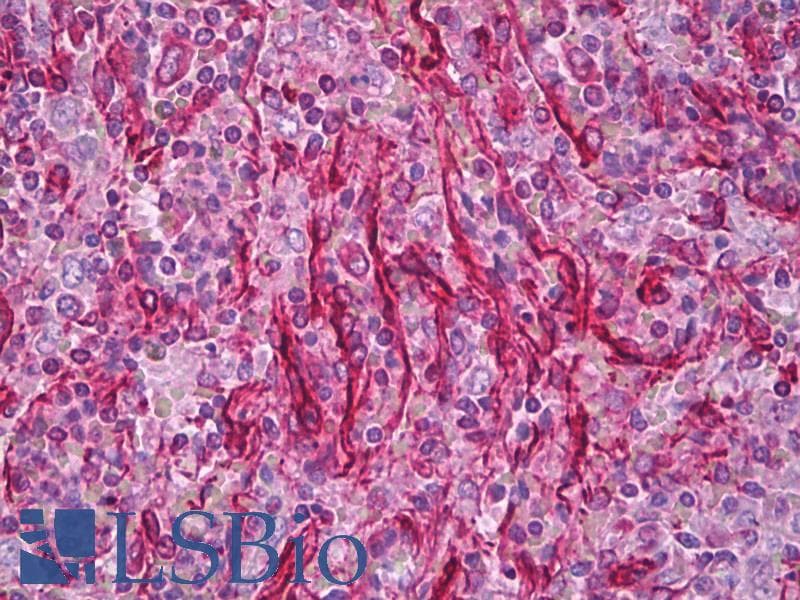 IHC-plus™ Vimentin Antibody (clone 33C7)