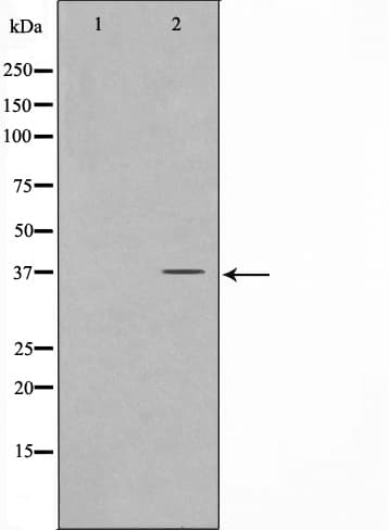 FOXL1 Antibody