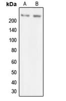 IHC-plus™ MYO7A / Myosin-VIIa Antibody (Internal)