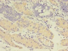 GDI2 Antibody (aa1-445)