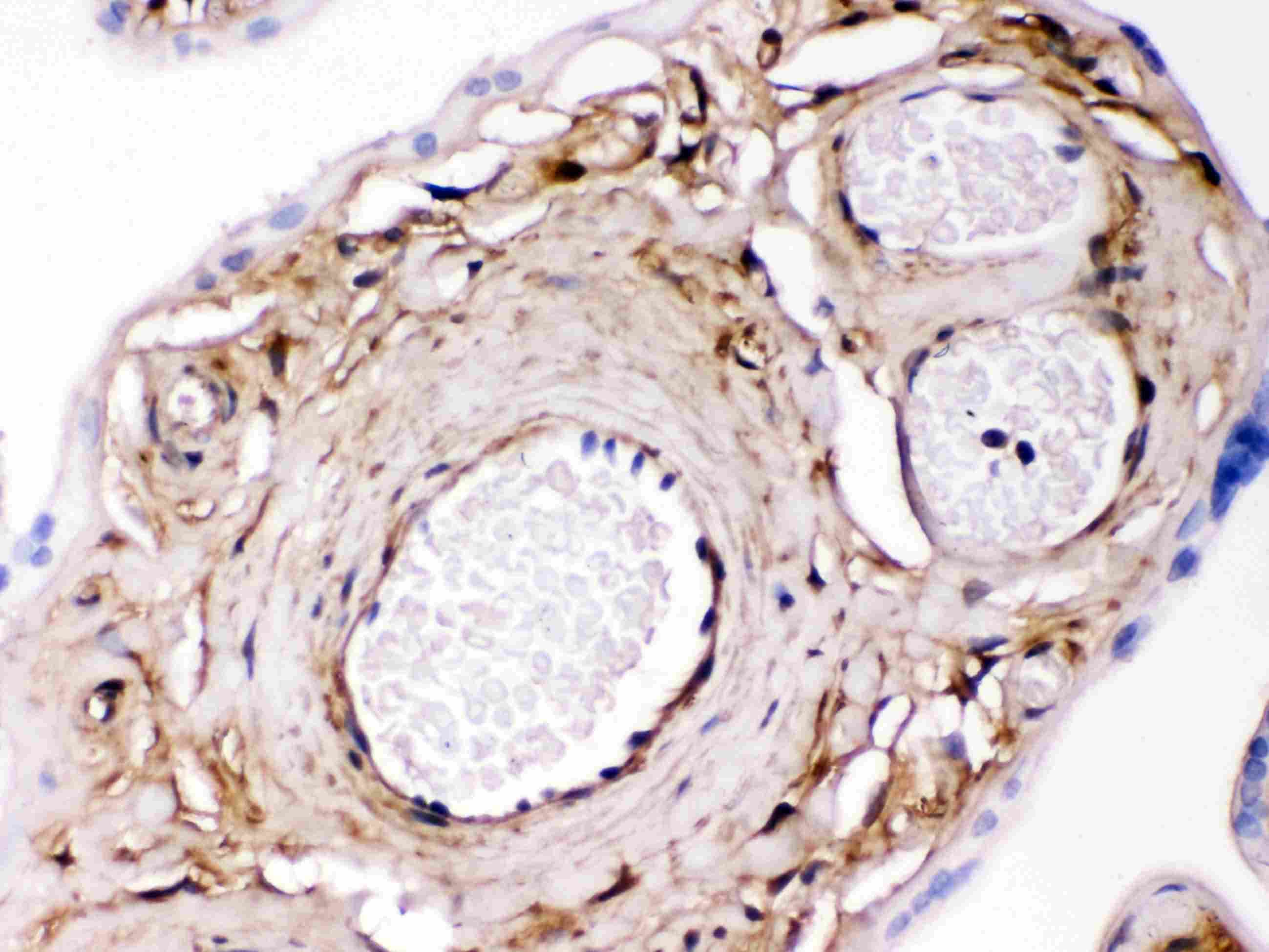 LGALS1 / Galectin 1 Antibody