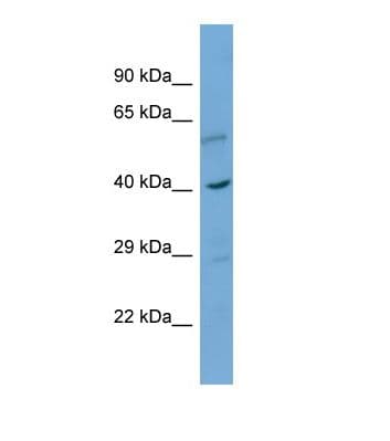 PathPlus™ Polyclonal Rabbit anti-Human CALR / Calreticulin Antibody (aa52-101, IHC, WB)