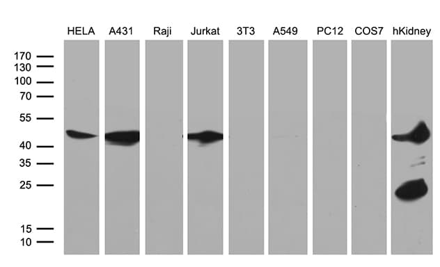ASS1 / ASS Antibody (C-Terminus, clone OTI12G1)