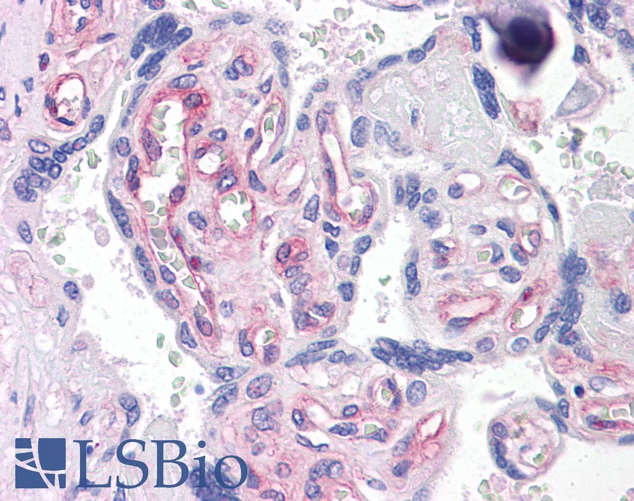 IHC-plus™ Monoclonal Mouse anti-Human ANXA4 / Annexin IV Antibody (clone 1D3, IHC, WB)